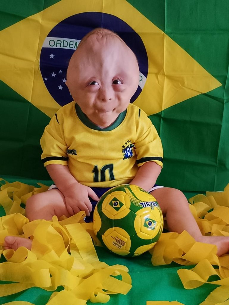 Família paraibana viraliza ao mostrar rotina com filho que nasceu com múltiplas malformações — Foto: Arquivo Pessoal / Rita de Cássia