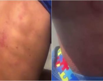 Policiais militares foram afastados para apuração de caso de agressão contra autista no RN — Foto: Reprodução