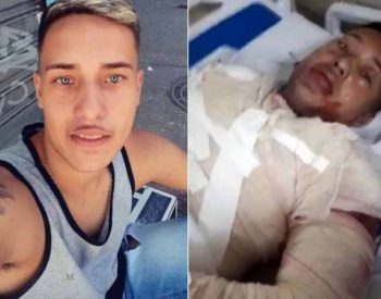 Daniel Jean Rocha Claudino teve queimaduras de segundo e terceiro grau após a mulher jogar gasolina em cima dele e atear fogo — Foto: Arquivo pessoal