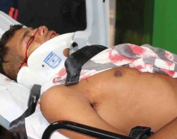 Carlos Eduardo Pacheco, de 23 anos, sofreu um tiro no nariz e não corre risco de morrer