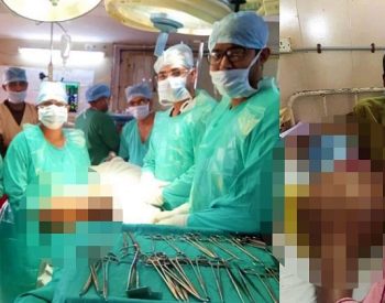 O menino perdeu metade do peso quando os médicos removeram a perna e o tumor. ( Foto: Arquivo do Hospital )