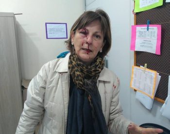 Professora agredida pelo aluno menor de idade.