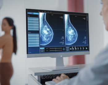 Mamografia — Foto: Adobe Stock