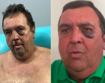 Vereador é agredido e amarrado em sequestro relâmpago no interior do RN — Foto: Cedida