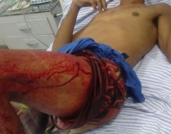 Vítima Leonardo da Silva Bezerra, 33 anos. ( Foto: Fim da linha )