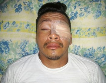 Marcio Barbosa, vítima do assalto, ficou com olhos e lábios feridos; caso foi levado à Polícia Civil (Foto: Rejane Ferreira/Arquivo pessoal)