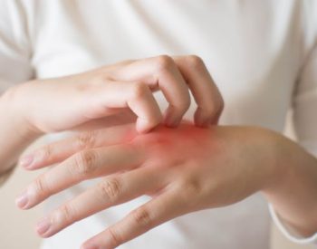 Foto — © Shutterstock