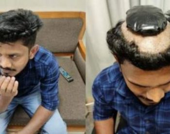 O homem desembarcou no aeroporto com 1,13 kg de ouro escondido numa peruca — Foto: Reprodução.