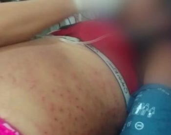 A mulher segue internada na UTI do Hospital Santa Catarina, em Natal, segundo informou a familia nesta sexta-feira (4). Foto — ©Divulgação.