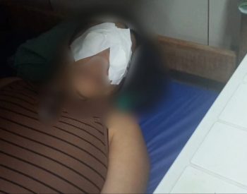 Servidora sofre queimadura na córnea após uso de produto químico no hospital Walfredo Gurgel — Foto: Reprodução