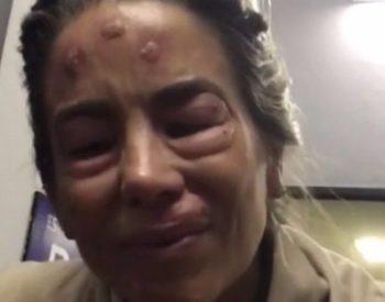 Nas imagens, ela aparece com alguns machucados na testa e os olhos inchados - REPRODUÇÃO