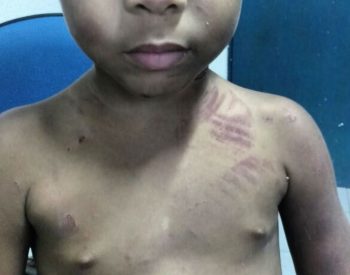 gressões a criança no Vergel, Maceió, foram denunciadas pelo Conselho Tutelar da região (Foto: Valmênia Santos/Conselho Tutelar)